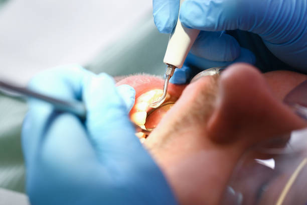 Best Emergency Root Canal Treatment in Princeton Meadows, NJ