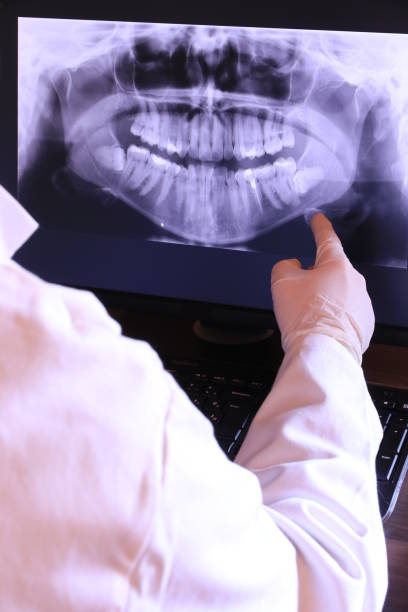 Best Emergency Tooth Extraction in Princeton Meadows, NJ