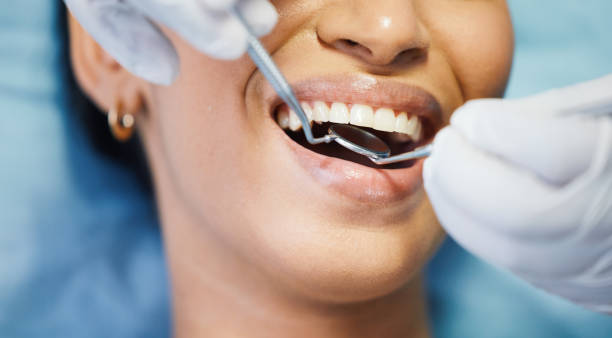Best Emergency Tooth Extraction in Princeton Meadows, NJ