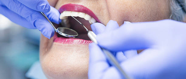 Best Emergency Treatment for Toothache in Princeton Meadows, NJ