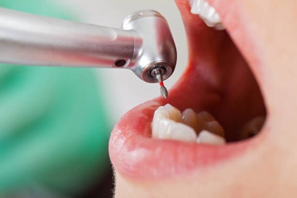 Best Pediatric Emergency Dentist in Princeton Meadows, NJ